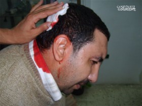 اعتداءات الأمن على مسيرات مرشحي الإخوان