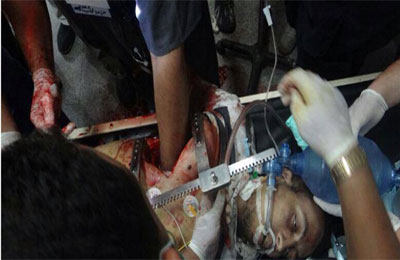 مجزرة الصائمين عند النصب التذكاري