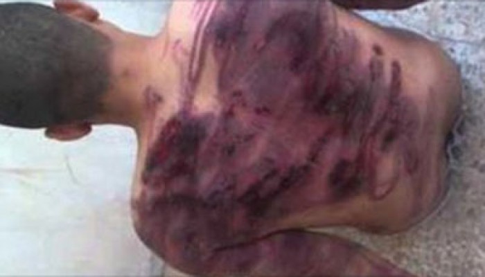 أسرة الطالب محمد عرفات تطالب بإنقاذ حياته من سلخانة الانقلاب