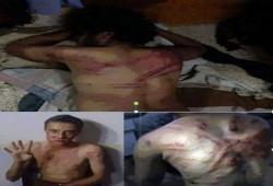 صور تظهر بشاعة التعذيب داخل سلخانة العازولي