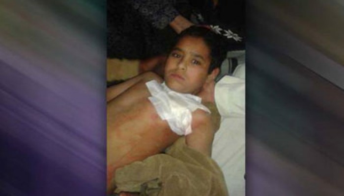 داخلية الانقلاب تعتقل طفلاً مصابًا بطلق ناري من المستشفى