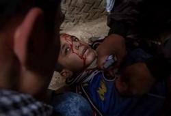 استشهاد طفل بالمطرية.. والثوار يواصلون حراكهم ضد الانقلاب