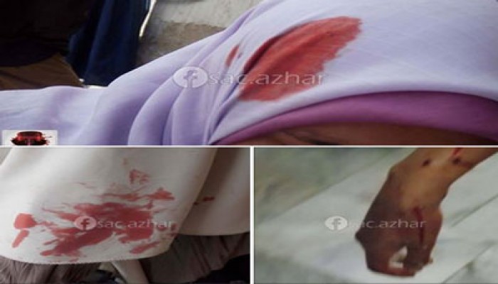 أمن الانقلاب يعتدي بالضرب والسحل على 3 طالبات بأزهر الخانكة