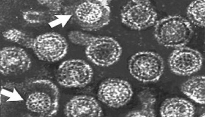 انتشار مرض الالتهاب الكبدي في سورية