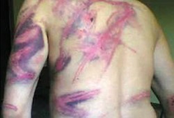 أسر معتقلي "ببا" تستغيث من تعذيب الانقلاب لذويهم بالكهرباء