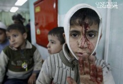 وفد طبي جزائري يصل غزة خلال أيام