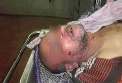 بالفيديو.. مجرمو الانقلاب يمثلون بجثة مواطن بعد تعذيبه بقسم الخانكة