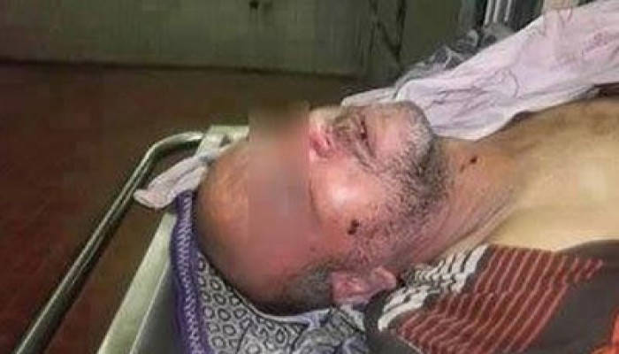بالفيديو.. مجرمو الانقلاب يمثلون بجثة مواطن بعد تعذيبه بقسم الخانكة