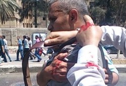 ميليشيات الانقلاب تعتدي على متظاهرين بميدان الكيت كات