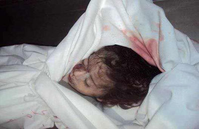 ارتفاع حصيلة العدوان على غزة إلى 309 شهداء و2268 جريحًا