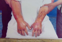 وفاة طالب معتقل بالإسكندرية بعد رفض الانقلاب علاجه