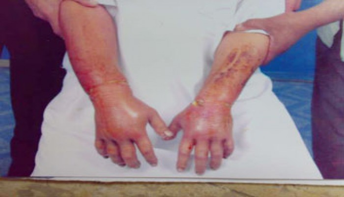 وفاة طالب معتقل بالإسكندرية بعد رفض الانقلاب علاجه