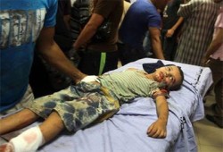 طبيب نرويجي: الكيان يستخدم أسلحة محرمة دوليًّا ضد غزة