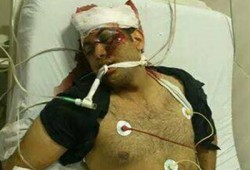 استشهاد كريم شامة بالمطرية متأثرًا بطلق ناري في جمعة الغضب