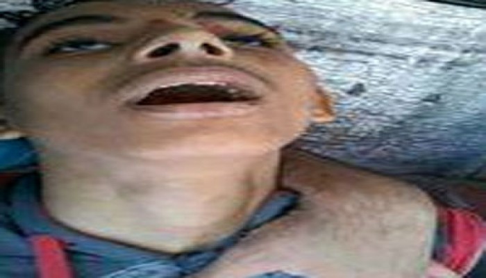 استشهاد طفل من الزيتون برصاص حي في مسيرة المطرية