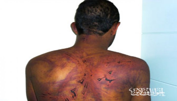 مصرع جنائي بقسم ثاني العاشر من رمضان نتيجة التعذيب