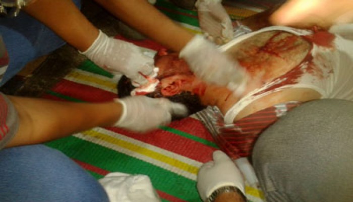 البلتاجي: الآن مجزرة بشرية بالرصاص الحي الرسمي أمام الحرس الجمهوري