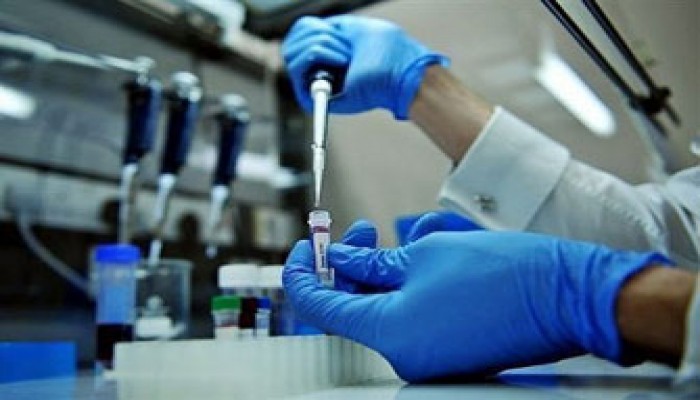 11 إصابة بأنفلونزا الخنازير بكردستان العراق