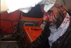 إصابة أحد مؤيدي الرئيس بطلق ناري بمحيط قصر"الاتحادية"