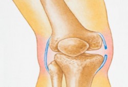 الطب البديل يساعد في علاج التهاب المفاصل