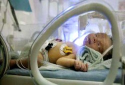 5 ولادات قيصرية متتالية تهدد حياة المرأة وتعرضها لمضاعفات خطيرة