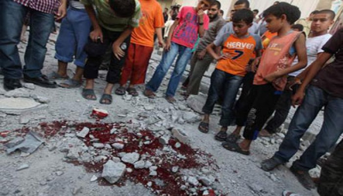 "اتحاد الأطباء العرب" يدين العدوان الصهيوني على غزة