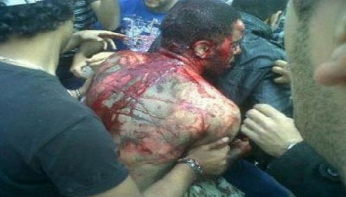 الشرقية.. أهالي "أبو حماد" ينددون بمجزرة العباسية