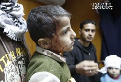 بالصور.. الكيان الصهيوني يستهدف التلاميذ وارتقاء الشهيد الـ"21"