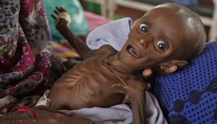 تراجع المجاعة في مناطق بالصومال