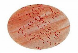 انتشار بكتيريا الليستيريا السامة في 18 ولاية أمريكية