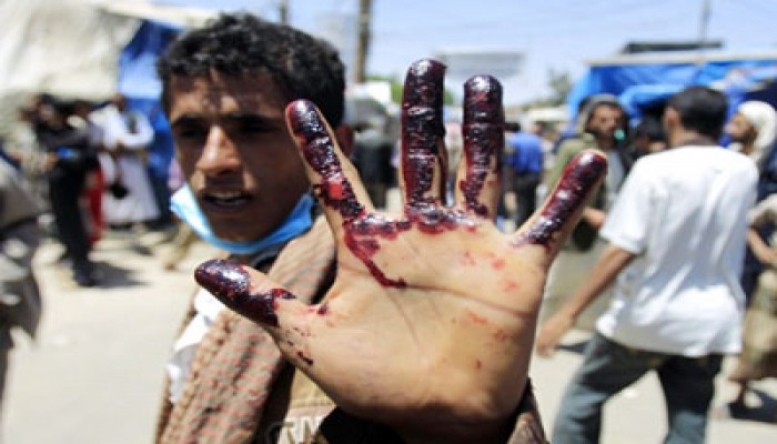 4 شهداء يمنيين وجرحى برصاص عصابات الديكتاتور صالح