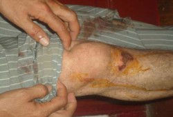 الاعتداء على أبو بركة بالقرب من وزارة الداخلية