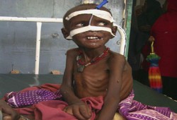 إخوان "مصر الثورة.." دور إيجابي لمساعدة منكوبي الصومال