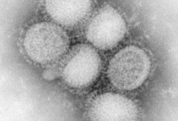 الصحة العالمية: تحور "محدود" لفيروس "الخنازير"