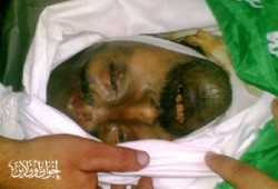 أبو زهري يرفض تقرير الطب الشرعي عن وفاة شقيقه