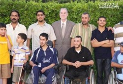 "الأطباء العرب" يكشف إصابة فلسطينيين بأورام سرطانية