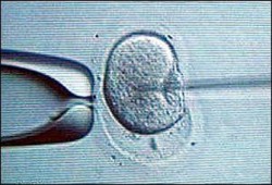 شبكة صهيونية عالمية للاتجار في البويضات البشرية