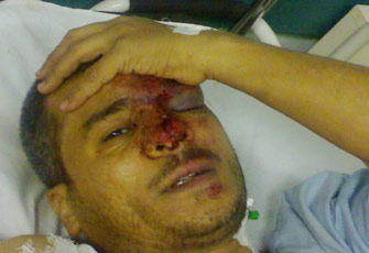 الطب الشرعي: إصابات فارس بركات نتيجة سقوطه من ارتفاع