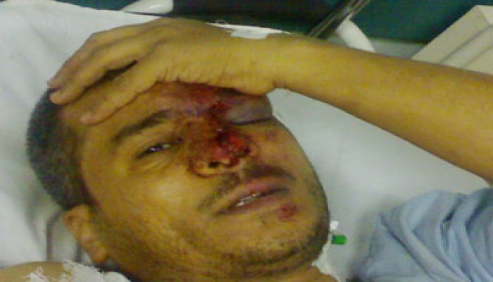 الطب الشرعي: إصابات فارس بركات نتيجة سقوطه من ارتفاع