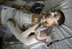 إسماعيل رضوان: التصعيد الصهيوني على غزة لابتزاز حماس