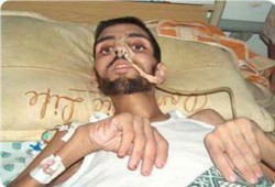 ارتفاع عدد ضحايا حصار غزة إلى 315