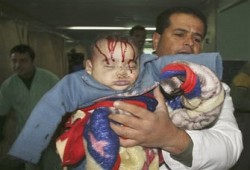 "الأطباء العرب" يرصد 600 إصابة بشظايا غير مرئية بغزة