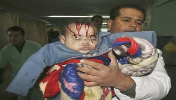 "الأطباء العرب" يرصد 600 إصابة بشظايا غير مرئية بغزة