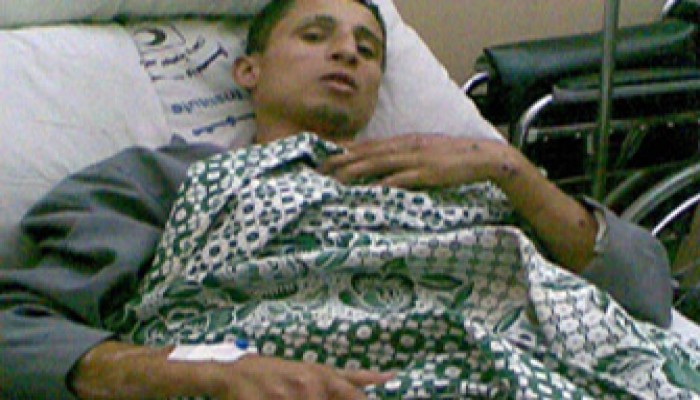 ارتقاء 31 من جرحى غزة في مصر