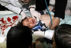 الوفد الطبي المصري: الإصابات في غزة لم نجدها في حروب سابقة!