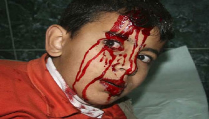 نداء من الإخوان المسلمين: يجب ألا يفلت مجرمو الحرب بجرائمهم