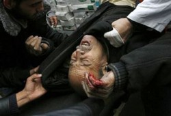 ضحايا مجزرة غزة حتى الآن 821 شهيدًا وأكثر من 3335 جريحًا