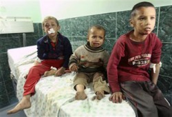 "أونروا": ما يحدث في قطاع غزة "جنون" غير مسبوق