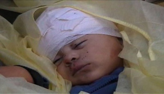 640 شهيدًا و3 آلاف جريح مع نهاية نهار دامٍ