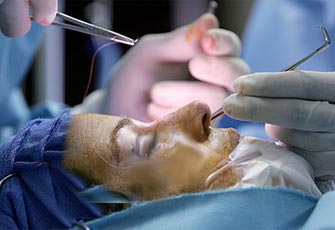 حكم عمليات التجميل